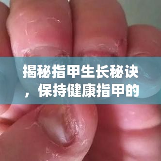 揭秘指甲生长秘诀，保持健康指甲的小技巧！